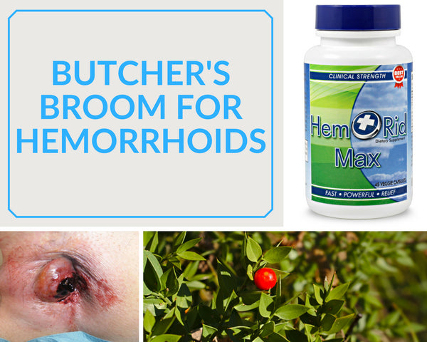 The Ultimate Guide to Using Butcher’s Broom for Hemorrhoids