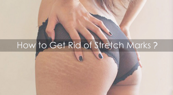 Red Marks On Buttocks During Pregnancy? BIG TROUBLE!