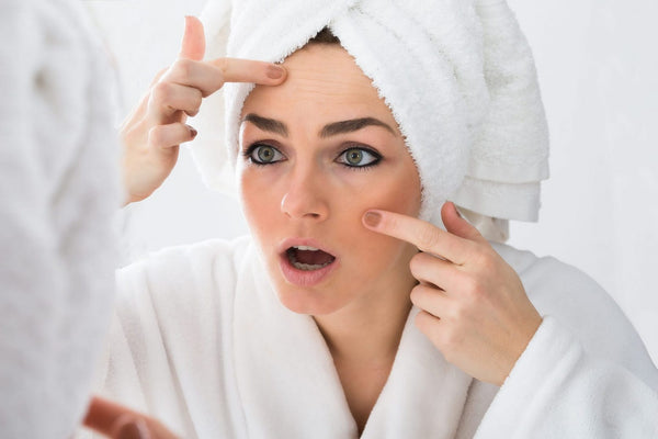 Acne Scars 101 - A Guide to Acne Scarring and Acne Scars Treatment