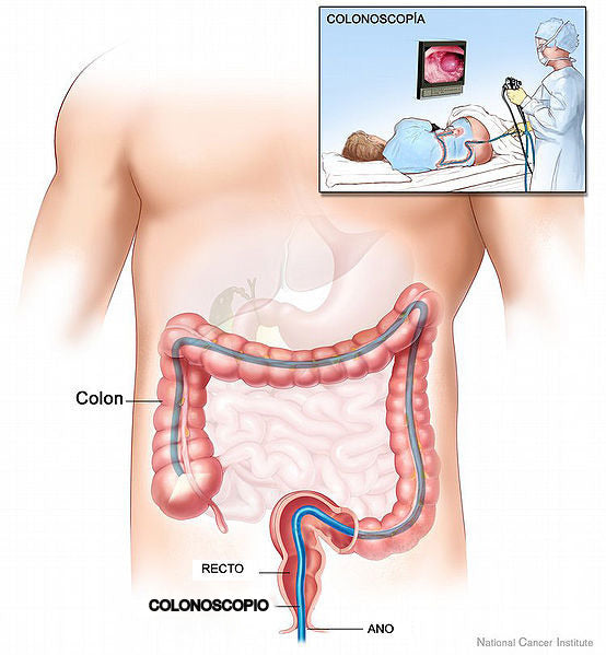 Hemorrhoids Colonoscopy Guide - Can a Doctor Fix Your Hemorrhoids During a Colonoscopy