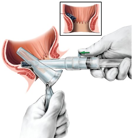 CRH O’Regan System Review - Cost, Complaints, Customer Reviews and More