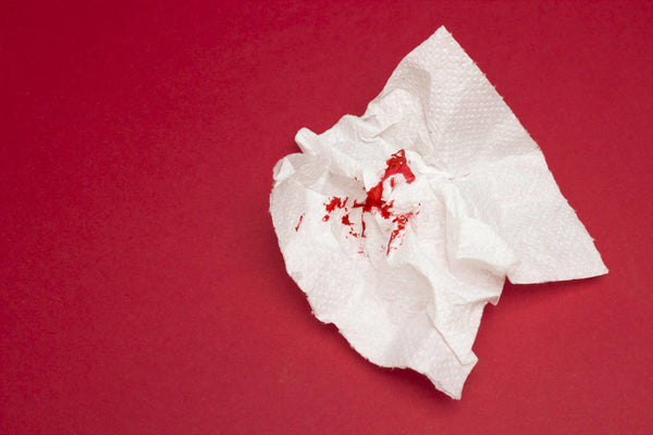 Hemorrhoid Blood Guide 101: What to do When You Have Bloody Hemorrhoids