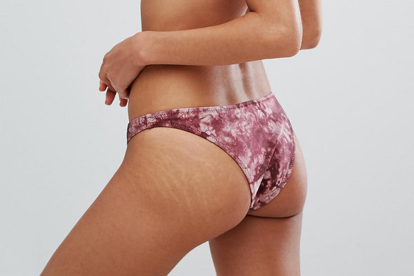 Top Pregnancy Stretch Mark Prevention Cream of 2017/2018: Product Purchasing Guide.