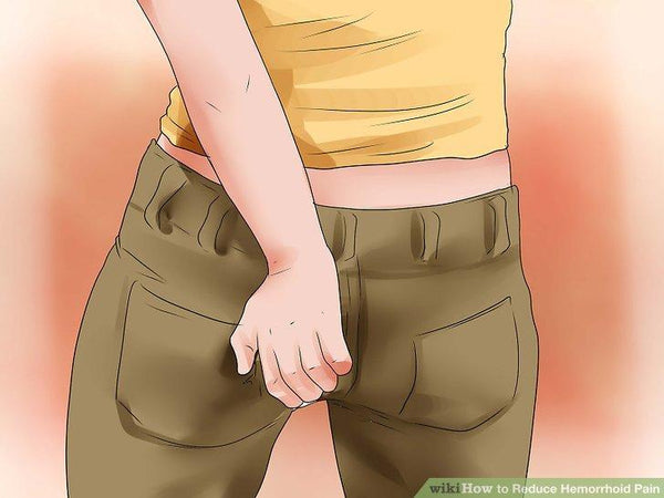 Why Do Hemorrhoids Itch and What You Can Do About Itching Hemorrhoids Today