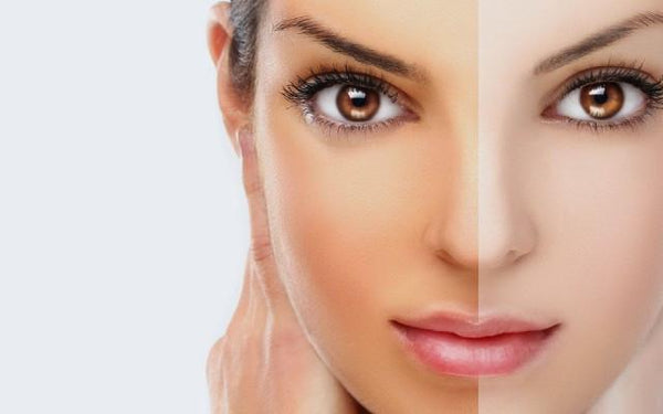How to Naturally Brighten Skin