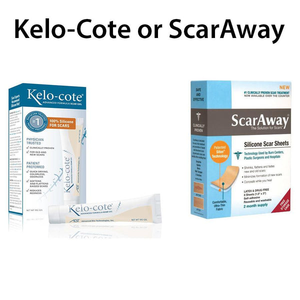 Kelo Cote vs Scaraway Review - Which Scar Remover is the Best Kelo Cote or ScarAway?