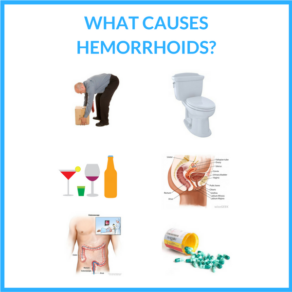Hemorrhoid Causes Guide 101: Discover What Causes Hemorrhoids and How You Can Stop Them!